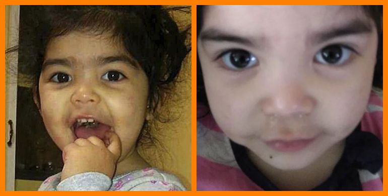 menina de 2 aos tem sobrancelha raspada pela escola _canguruonline (1).JPG (39 KB)